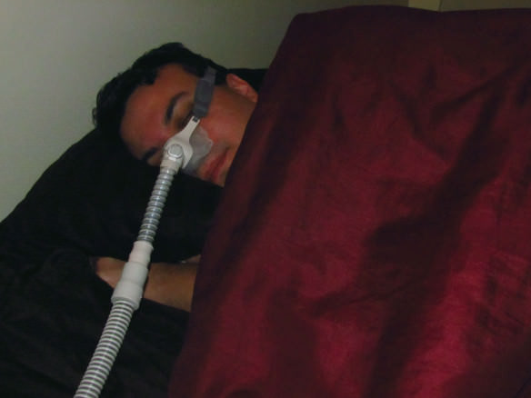 Sleep Apnea - CPAP